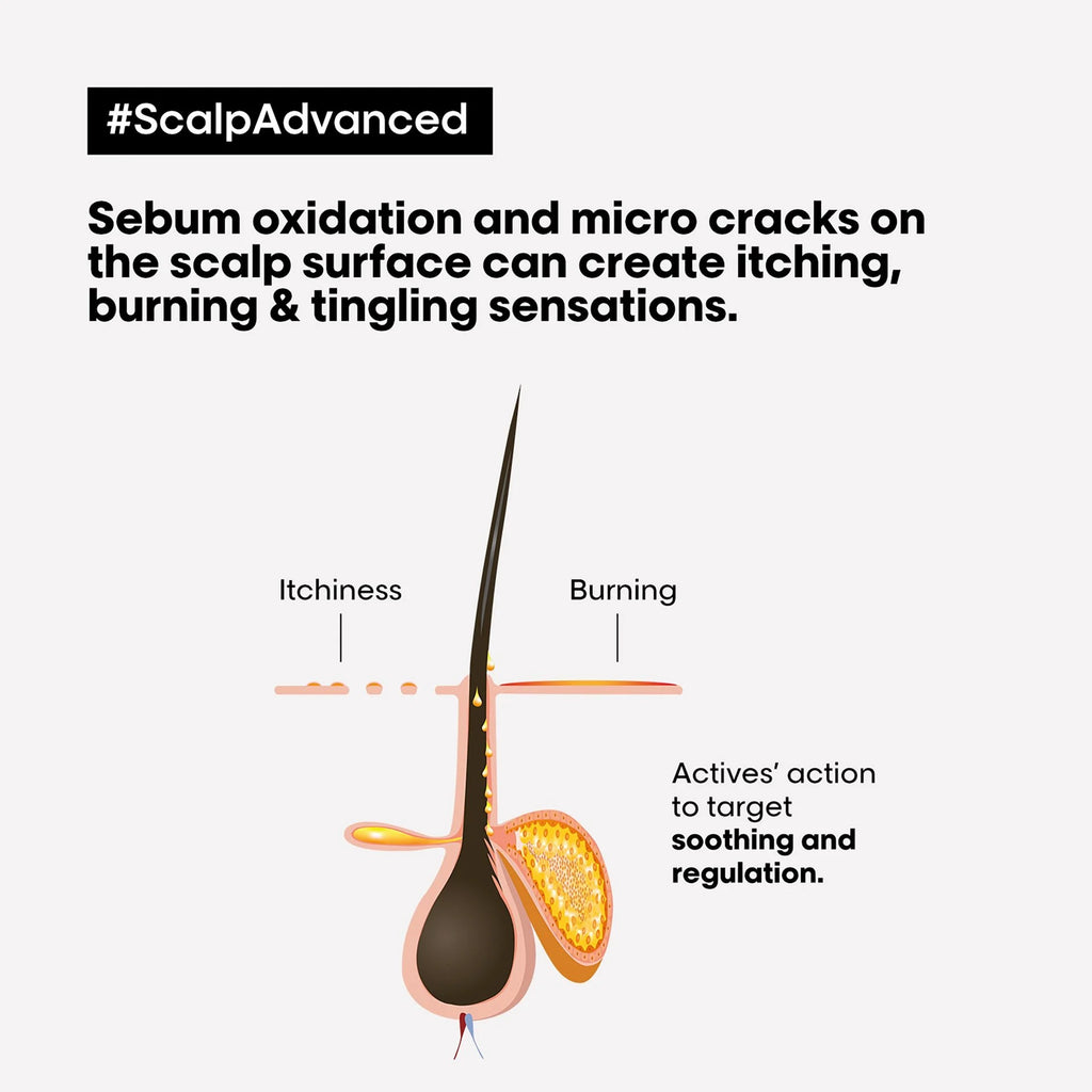 L'Oréal Professionnel Serie Expert Scalp Advanced Anti-Discomfort 200 Ml