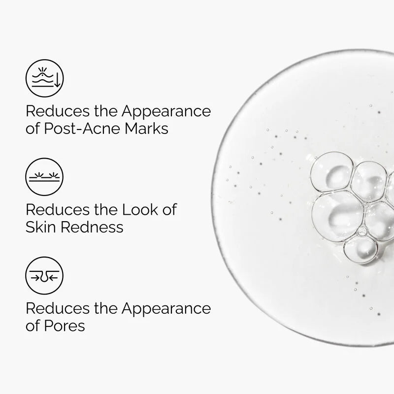 The Ordinary Aloe 2% + NAG 2% Solution 30ml | Post-Acne Mark Treatment