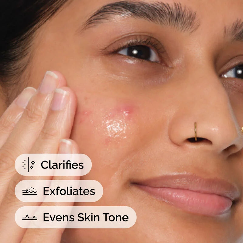 The Ordinary Salicylic Acid 2% Anhydrous Solution 30 Ml