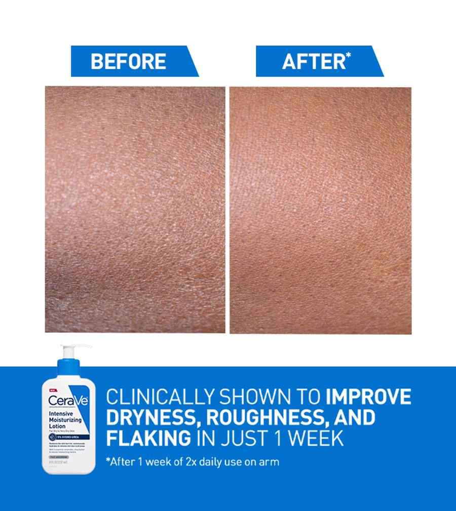 CeraVe Intensive Moisturising Lotion 236ml for Dry to Extra Dry Skin