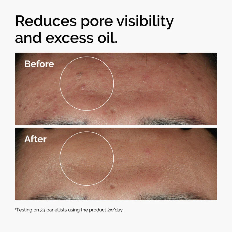 The Ordinary Niacinamide 10% + Zinc 1% Serum 60ml