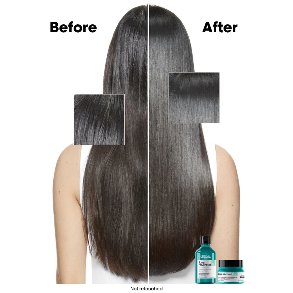 L'Oréal Professionnel Scalp Advanced Anti-Oiliness Shampoo 300ml