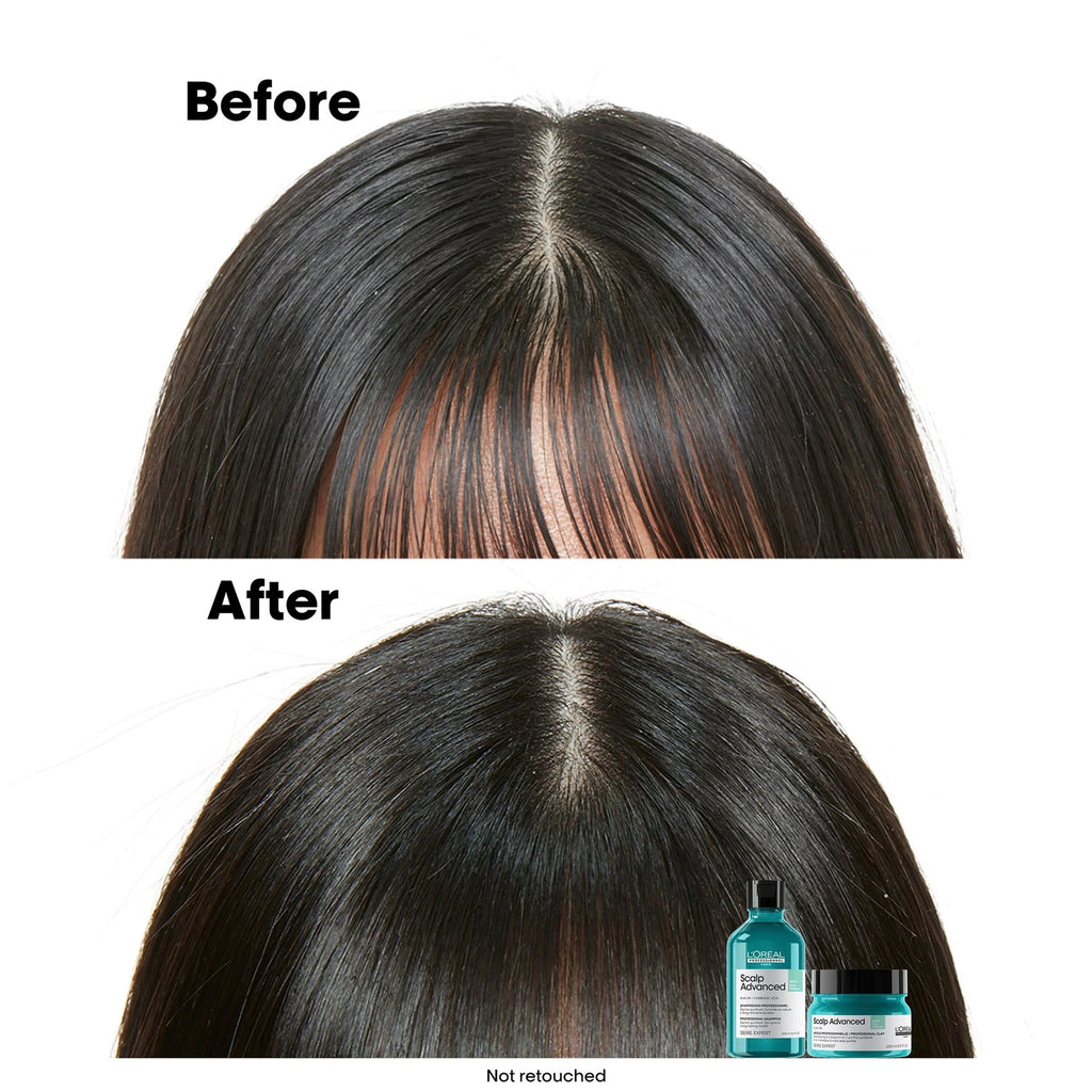 L'Oréal Professionnel Scalp Advanced Anti-Oiliness Shampoo 300ml