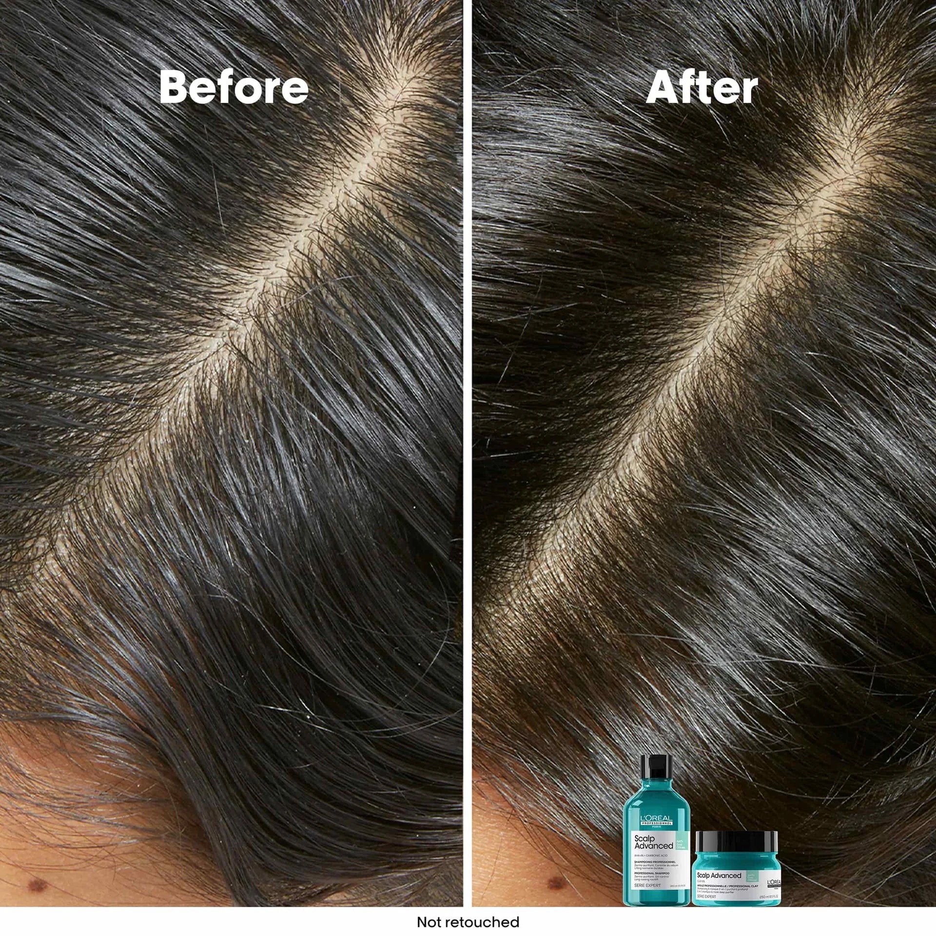 L'Oréal Professionnel Scalp Advanced Anti-Oiliness Shampoo 300ml